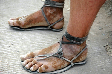 sandals